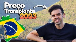 Implante Capilar Fue Qual o preço no Brasil [upl. by Neeven]