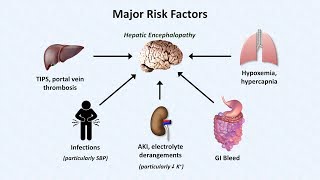 Hepatic Encephalopathy [upl. by Pessa]