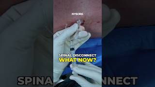 Spinal Disconnect What now spinal anesthesia disconnect [upl. by Artemahs]