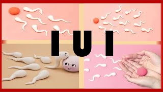 Intrauterine Insemination IUI  What is an IUI  How to get Pregnant with an IUI [upl. by Yorel465]