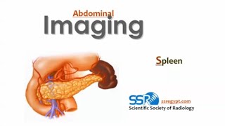 Splenic imaging DRE Prof Mamdouh Mahfouz [upl. by Eula]