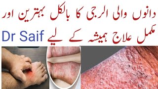 Kharish Ka Fori Ilaj  kharish ka ilaj and medicine  allergy ki best medicine dano wali allergy [upl. by Arlan]