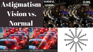 Astigmatism Vision vs normal Astigmatism Symptoms What is astigmatism [upl. by Zink]