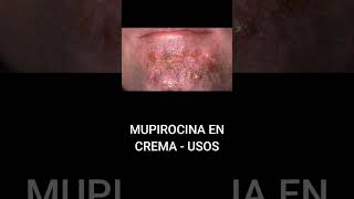 MUPIROCINA EN CREMA  USOS [upl. by Trevlac]