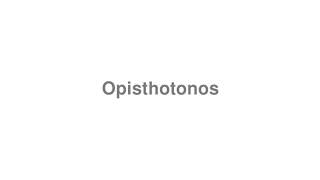 How to Pronounce quotOpisthotonosquot [upl. by Luis390]