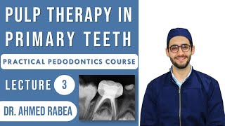 Lecture 03  Pulp Therapy in Primary Teeth  Pulpotomy vs Pulpectomy  كورس بيدو عملي [upl. by Alathia]