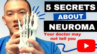 5 Secrets about Neuromas your doctor may not tell you [upl. by Regazzi]