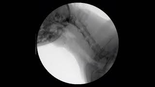 Canine mainstem bronchial and tracheal collapse fluoroscopy [upl. by Brodie]