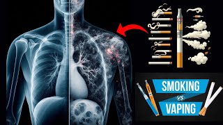 Vaping or Cigarettes Which Is More Harmful  Vaping vs Cigarettes [upl. by Salvucci624]