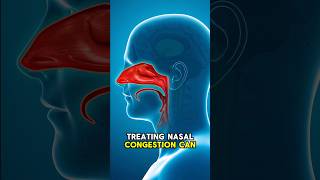 How To Overcome SLEEP APNEA with Nasal Congestion Solutions shorts [upl. by Hilaire]