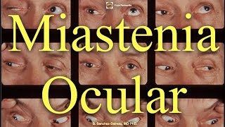 Miastenia Ocular [upl. by Relda]