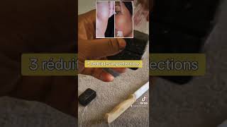 Savon clarifiant anti imperfections skincare beauty diy skincareroutine [upl. by Saw]