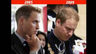 Prince Williams beauty before  after Kate in pictures [upl. by Selestina]