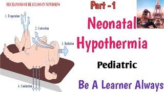 Neonatal Hypothermia [upl. by Nawj383]