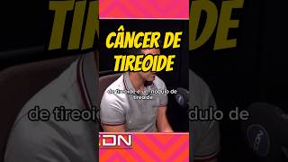 Câncer de tireoide Quando desconfiar endocrinologia tireoide cancer [upl. by Rye]