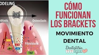 CÓMO FUNCIONAN LOS BRACKETS  Movimiento Dental [upl. by Eerak843]