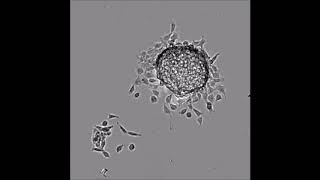 Spontaneous migration of cellular aggregates from giant keratocytes to running spheroids [upl. by Milurd]