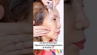 Get Rid Of Dark Spot  PigmentationHyperpigmentation Wrinkle subscribe skincare beauty shorts [upl. by Stefanac984]