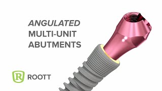 Angulated Multiunit Abutments for ROOTT R [upl. by Joane496]