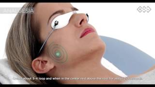 Facial Nerve Paresis Treatment Using BTL High Intensity Laser [upl. by Dunson574]