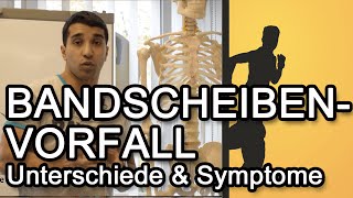 Bandscheibenvorfall  Unterschiede amp Symptome [upl. by Awad]