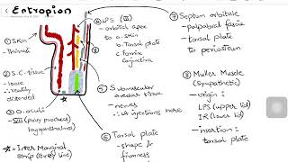 Entropion  with Lid Anatomy amp Surgical Management [upl. by Kramlich546]