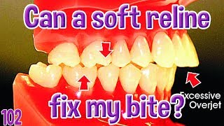 Can a soft reline fix my dentures bite [upl. by Hervey]