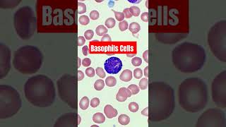 Basophils Cells  Blood smear slide microscopy Basophils bloodtest dmltlab viral trrndings [upl. by Anila]