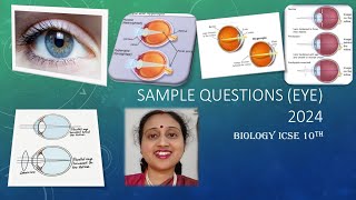 SampleQuestionSenseOrganEyeBiologyICSE10tMyopiaHypermetropiaPresbyopiaAstigmatism [upl. by Arihppas573]