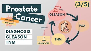 Prostate Cancer Labelled  3D Medical Animation  ABP © [upl. by Eneleoj187]