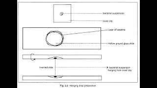 Hanging Drop PreparationPositive [upl. by Astera]