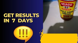 PT 2 Great results in 7 days  Continuing apple cider vinegar benefits [upl. by Latty]