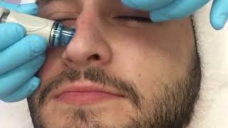 MENS SKIN CARE TRUECARE HYDRAFACIAL MD [upl. by Amerigo741]