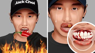 ASMR Treating mouth ulcers caused by eating spicy foods for Zach Choi Mukbang  WOW Brain Kr video [upl. by Oswin]