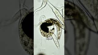 Dois protozoários caçadores disputam a mesma presa microbiologia microorganismos [upl. by Marcell]