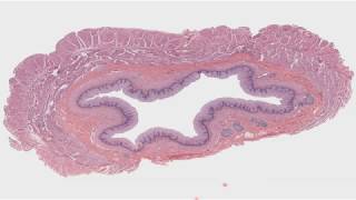 Histología del sistema digestivo II Tubo digestivo CAPÍTULO 13 [upl. by Keligot]