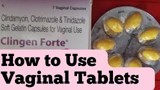 Vaginal tablets kese use krte h How to use Vaginal Tablets [upl. by Burny]