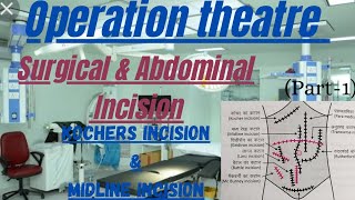 Abdominal IncisionSurgical IncisionKochers IncisionMidline Incision Abdominal Incision site [upl. by Larner268]