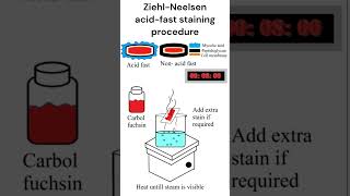 Ziehl Neelsen Acid fast staining procedure staining acidfast microbiology [upl. by Mellicent482]