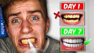 TEETH WHITENING PENS Do They Work 7 day challenge [upl. by Vaasta521]