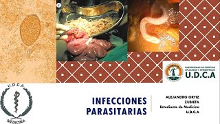 Infecciones parasitarias  Alejandro Ortiz [upl. by Weeks]