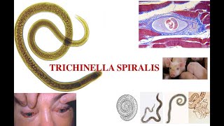 Triquinella spiralis [upl. by Rexanna]