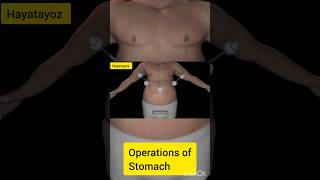 Operations of Stomach anatomy science humananatomy humanphysiology [upl. by Ibmat]