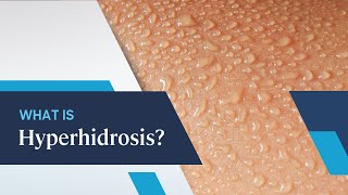 What is Hyperhidrosis [upl. by Kelula]