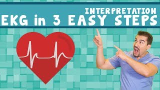 EKG interpretation  PQRST memory Trick  in 3 easy steps Part 2 [upl. by Ardnalak]