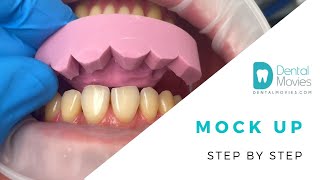 Mock up  Step by step 🦷💡 [upl. by Allison]