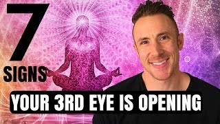 Third Eye Opening  7  Signs Your 3rd Eye Is Opening [upl. by Eizzik]