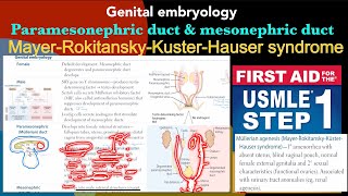 Genital embryology Male amp Female development ￼ Mullerian agenesis in HindiUrdu by USMLE step 1 [upl. by Stelu]