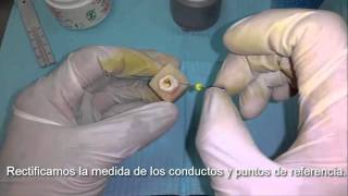 Endodoncia de principio a fin quotPráctica de Laboratorioquot [upl. by Nahgaem352]