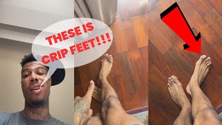 BlueFace Explains What Happened To His CROOKED Feet “These Is Crip Feet”🤣🤣🤣😭😭😭 [upl. by Rennane]